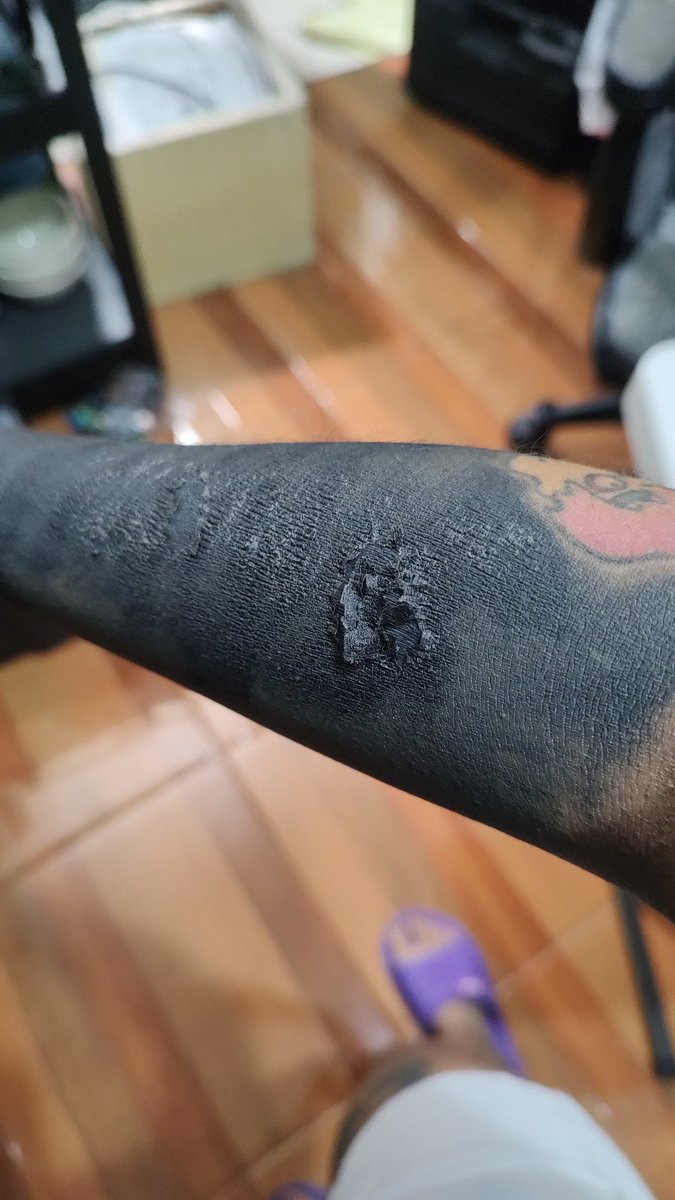EndPech's tweet photo. Cambio de piel #blackout 

🐍 https://t.co/36CNP72SZ2