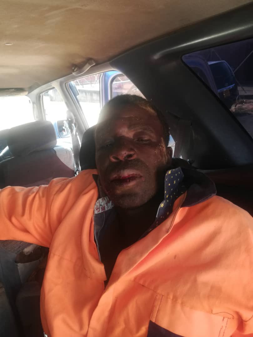 📺ELECTION UPDATE: We are appalled by the violent actions carried out by Zanu PF thugs, led by Innocent Dambudzo Benza, the aspiring MP for Mutasa Central, against our polling agents. Our members have suffered severe injuries. We firmly condemn this behavior, as it undermines the