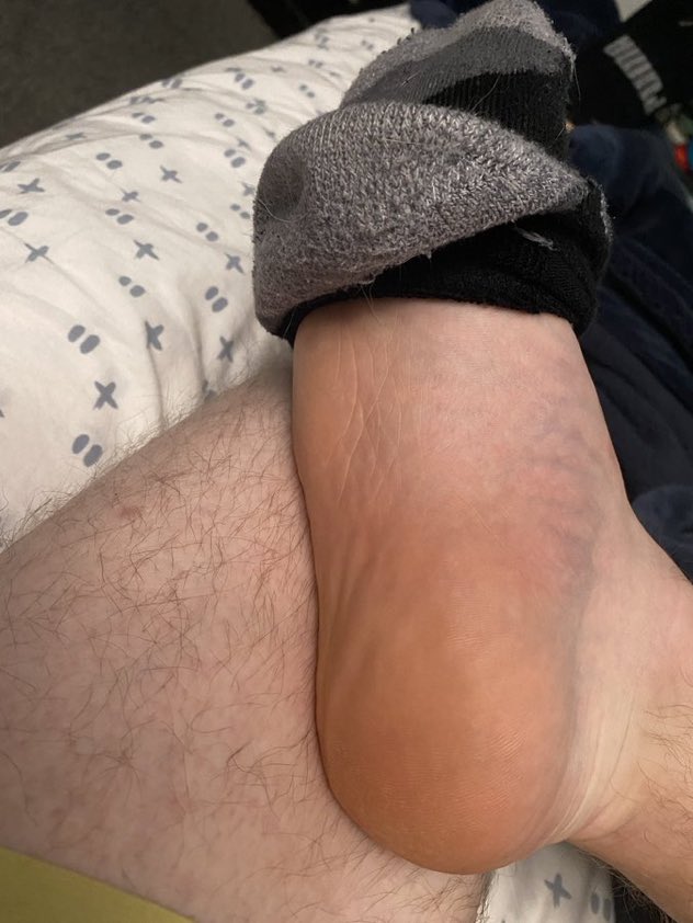 Who’s ready to be ruined?

#paypig #fagtax #payup #cashfag #loser #findom #cashmaster #cashsub #alpha #footmaster #paypig #finsub #walletdrain #humanatm #BWC #humanwallet #cashfag #cashpig #master #findomfeet #feetmale #feetworshi̇p #feet #sock