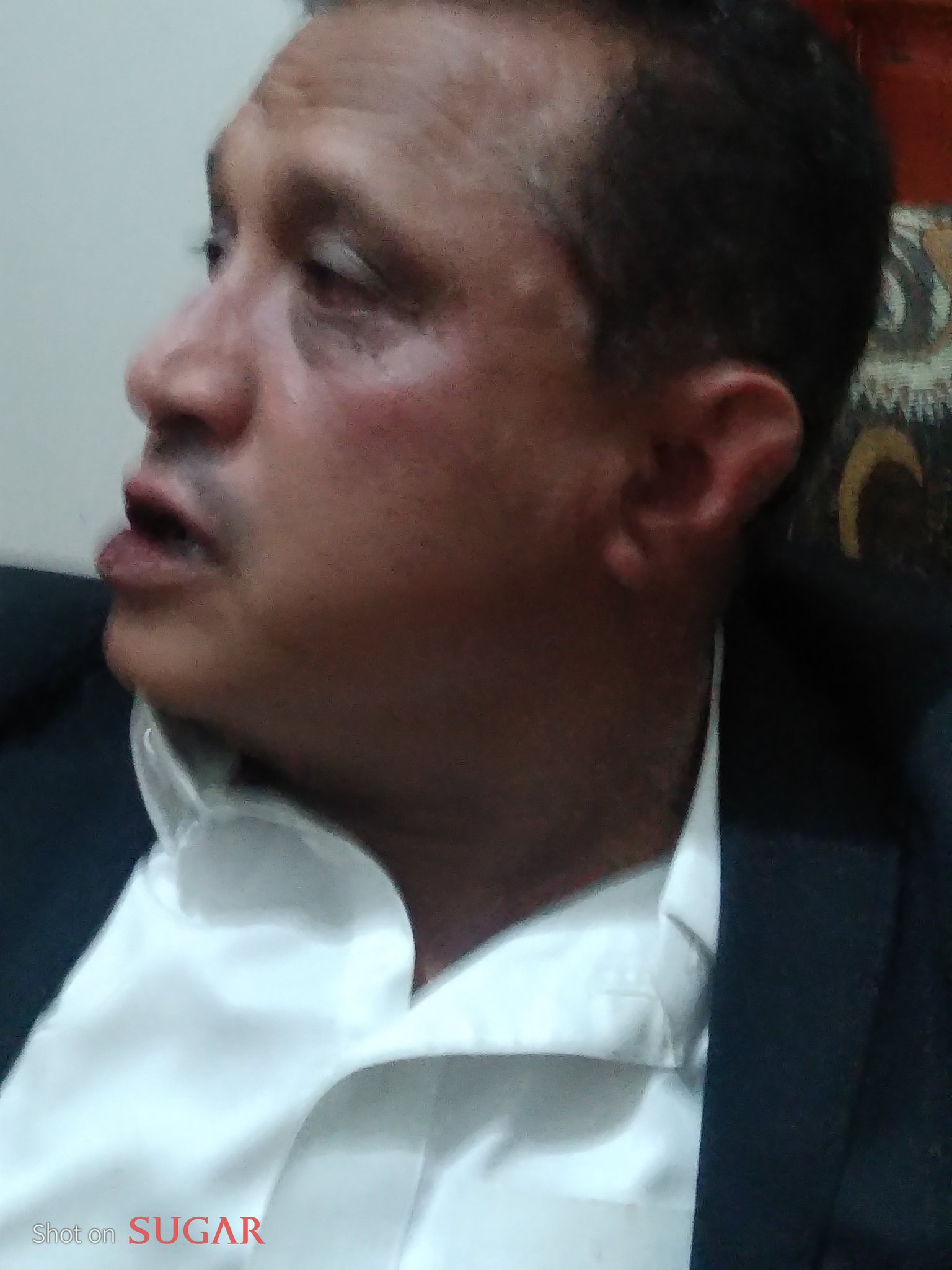 الصورة