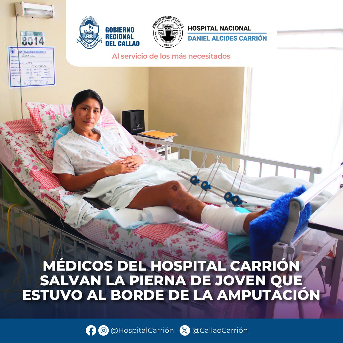 #NotaDePrensa 📰 | Gabriela Bravo Solano 👩, llegó a nuestro hospital luego de recibir pronósticos desalentadores en otros hospitales.

Lee la nota completa 👉 bit.ly/3YL21Dj
#HazañaMédica 💙 #OrgulloCarrión