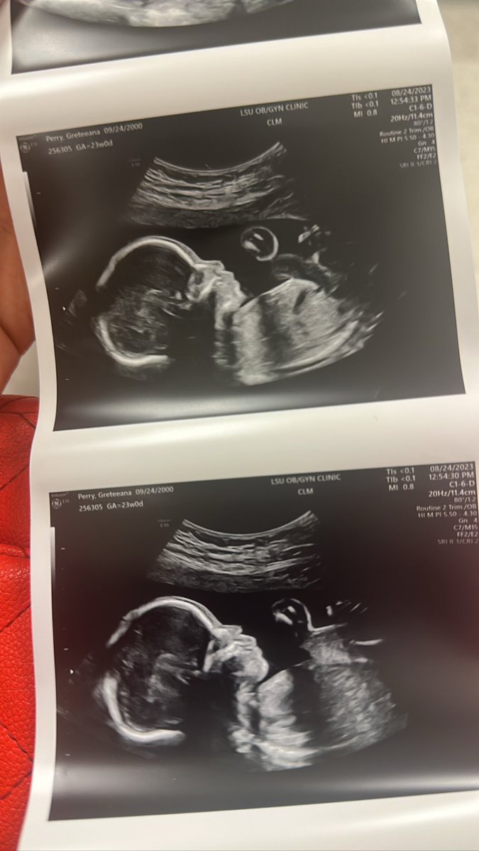 darealbg_'s tweet photo. MY biggest blessing π mommies bestfriend , a special gift from god & mimi in heaven π«ΆπΌ #G2otw #Decbaby #23weekstoday https://t.co/toDPsApR02