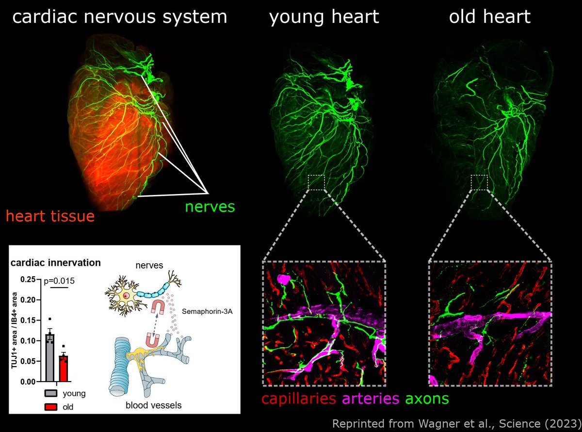 Julian Wagner (@julianw27954793) on Twitter photo Ageing can be quite nerve-wracking! This is especially true for the old heart. See my very first Science paper to learn more! 😎
science.org/doi/full/10.11…
Thanks so much for this massive team effort <a href="/InstCardReg_FFM/">Institute of CVR</a> <a href="/StefanieDimmel1/">Stefanie Dimmeler</a> <a href="/gluxan/">Guillermo Luxán</a> <a href="/th3k4ty/">Dr. Katharina Scherschel</a> Ageing can be quite nerve-wracking! This is especially true for the old heart. See my very first Science paper to learn more! 😎
science.org/doi/full/10.11…
Thanks so much for this massive team effort <a href="/InstCardReg_FFM/">Institute of CVR</a> <a href="/StefanieDimmel1/">Stefanie Dimmeler</a> <a href="/gluxan/">Guillermo Luxán</a> <a href="/th3k4ty/">Dr. Katharina Scherschel</a>