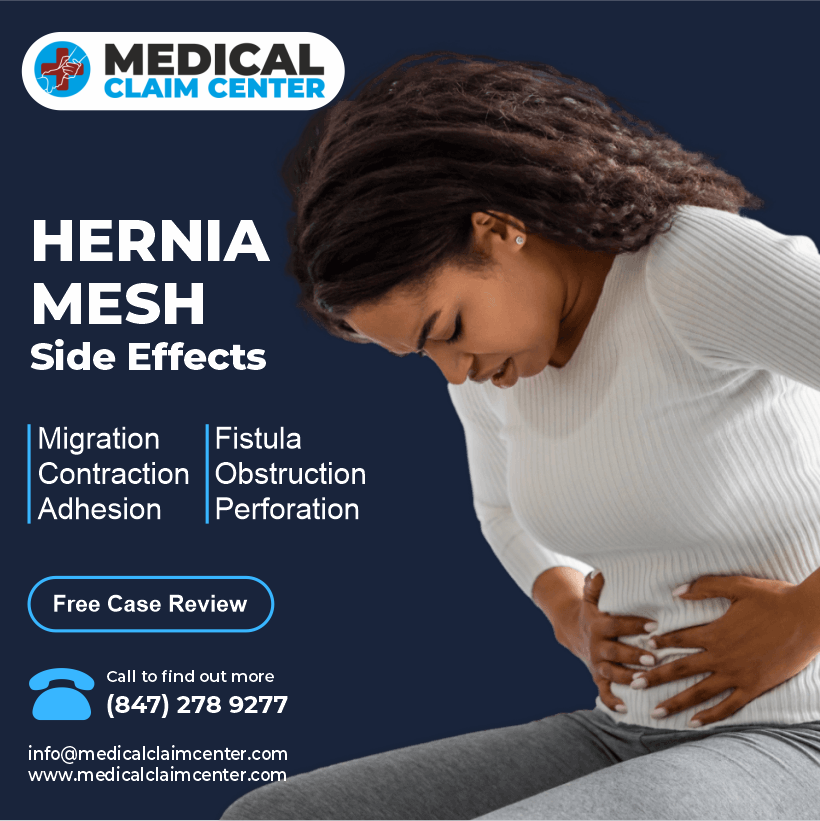 🩹 Considering Hernia Mesh Surgery? Be aware of potential side effects:
Migration 
Contraction
Adhesion
Fistula
Obstruction
Perforation
Your health matters, so stay informed! 💪 #HerniaMesh #HealthAwareness #HerniaMeshLawsuit