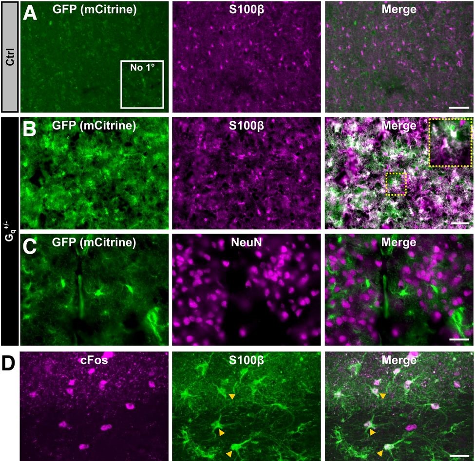 SfNJournals's tweet image. #JNeurosci: Findings from @AshleyIngiosi et al. @MGFrankLab @WSUMedicine indicate time spent awake is not singularly sufficient to increase #sleep need—basal forebrain astrocytes also play an active role in regulating this process in mice.
jneurosci.org/lookup/DOI/10.…