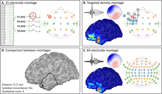 AnphyLab's tweet photo. Target your scalp electrodes! check out Alex's new paper on the new target density montage  

https://t.co/wXLBULVbqA https://t.co/rJula5VYKC