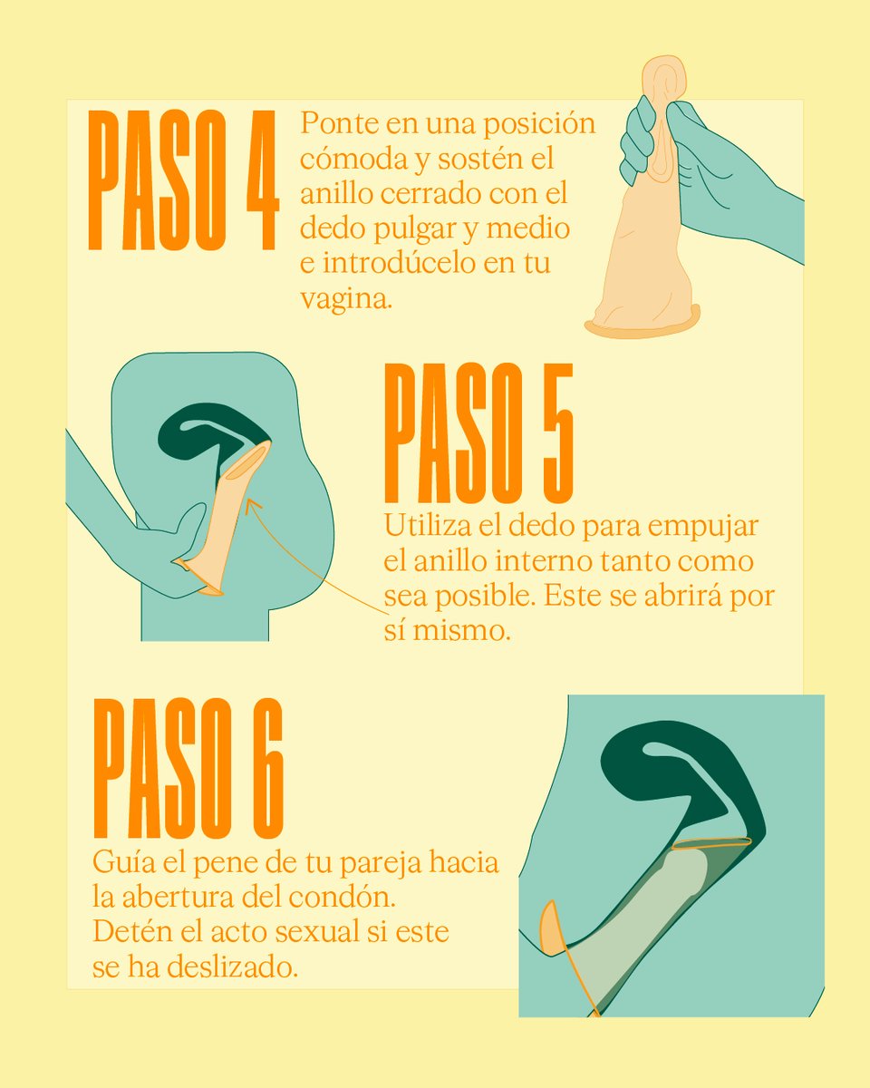 seremisalud10's tweet image. Conoce las características y el uso correcto del #CondónInterno o de vagina para prevenir infecciones de transmisión sexual y #VIH.
Más info👉bityl.co/KMIe