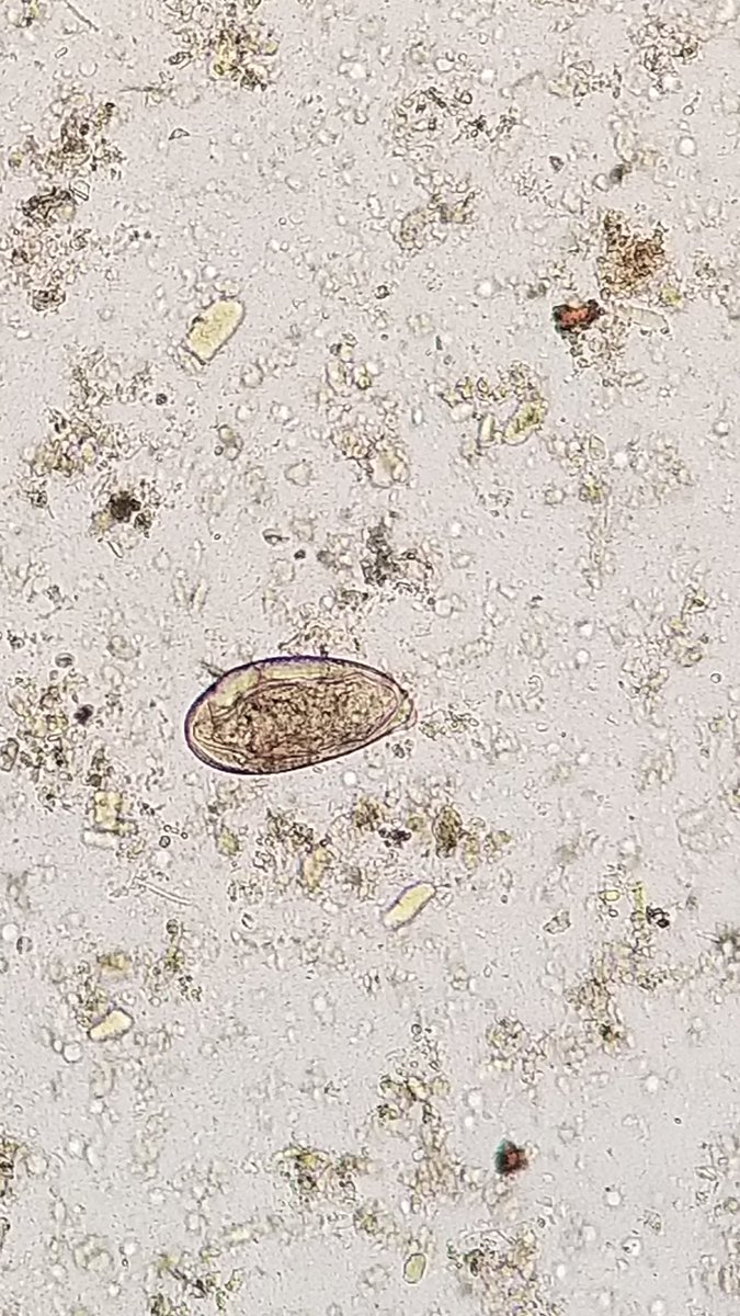 lab_phot's tweet photo. What do you see ?
#stooltest
The answer on
https://t.co/JklpX5j4pD https://t.co/K4jq3CXGpr