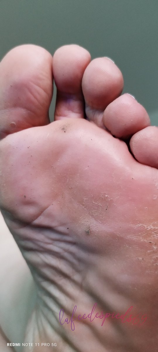 lafeedespieds__'s tweet photo. Mes petits pieds salles tu viens lécher ? 
#pieds #feet_lover #feetfinder #feetpicsforsales https://t.co/DUTrO6GQKW