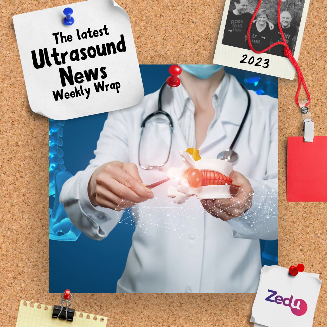 Zedu Ultrasound Training @zedunow@med-mastodon.com (@zedunow) on Twitter photo The #weeklywrap of #ultrasound news, views & information is here
💎gems from
<a href="/MH_EMultrasound/">MetroHealth Emergency Ultrasound</a>
<a href="/coreultrasound/">Jailyn/Ben</a>
<a href="/stemlyns/">Saint Emlyn's</a>
<a href="/Doktorarvig/">Michael Dan Arvig</a>
<a href="/EUSmkh/">Meghan Herbst</a>
...and much more
📺Turn on, tune in & avoid dropout...😎
ultrasoundtraining.com.au/news/zedu-week…
#POCUS #ultrasoundtraining The #weeklywrap of #ultrasound news, views & information is here
💎gems from
<a href="/MH_EMultrasound/">MetroHealth Emergency Ultrasound</a>
<a href="/coreultrasound/">Jailyn/Ben</a>
<a href="/stemlyns/">Saint Emlyn's</a>
<a href="/Doktorarvig/">Michael Dan Arvig</a>
<a href="/EUSmkh/">Meghan Herbst</a>
...and much more
📺Turn on, tune in & avoid dropout...😎
ultrasoundtraining.com.au/news/zedu-week…
#POCUS #ultrasoundtraining