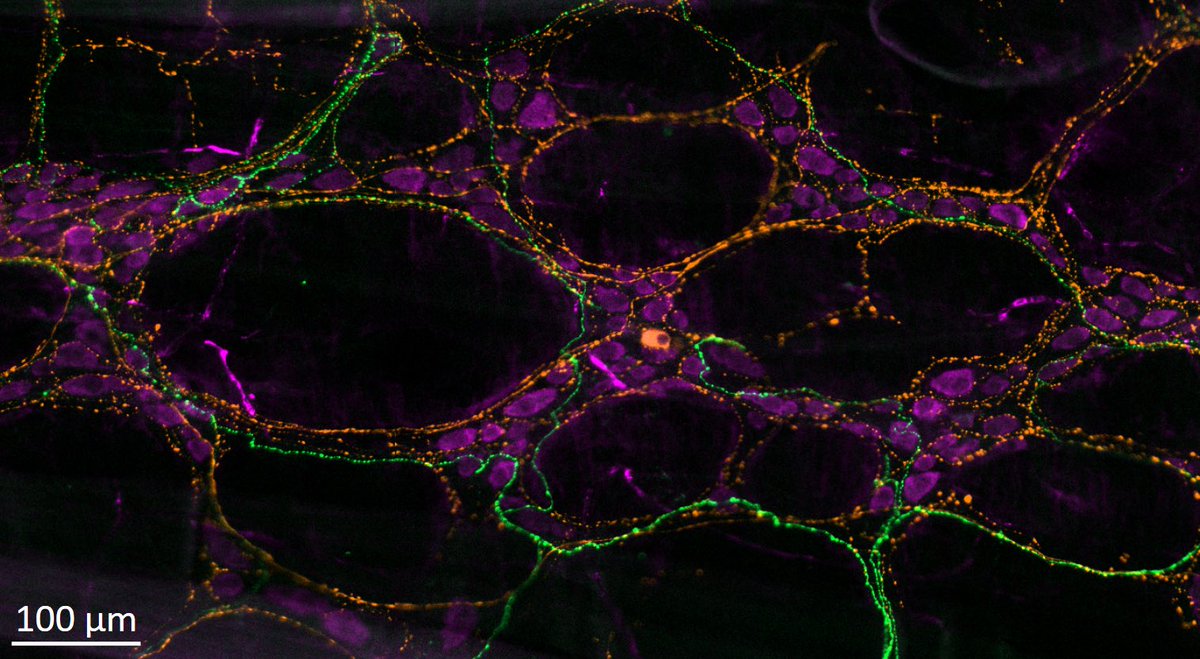 Anatomy & Physiology Students Society (APSS) (@apssunimelb) on Twitter photo Some inspiration for your Under the Coverslip posts!
Neurons in the mouse stomach - image by Honours student <a href="/chaanyag/">Chanya Gajanaike</a>
Happy #fluorescentfriday! 🦠🔬
<a href="/BioSci_UniMelb/">BioSciences UniMelb</a>
<a href="/UniMelbMDHS/">UniMelb MDHS</a> Some inspiration for your Under the Coverslip posts!
Neurons in the mouse stomach - image by Honours student <a href="/chaanyag/">Chanya Gajanaike</a>
Happy #fluorescentfriday! 🦠🔬
<a href="/BioSci_UniMelb/">BioSciences UniMelb</a>
<a href="/UniMelbMDHS/">UniMelb MDHS</a>