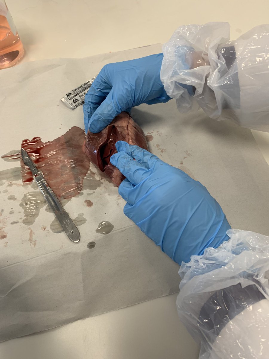 BeckRSaunders's tweet photo. #IB #Biology #Topic6 #HeartDissection … some surgical careers ended today 😂 https://t.co/pzgrEQHbFh