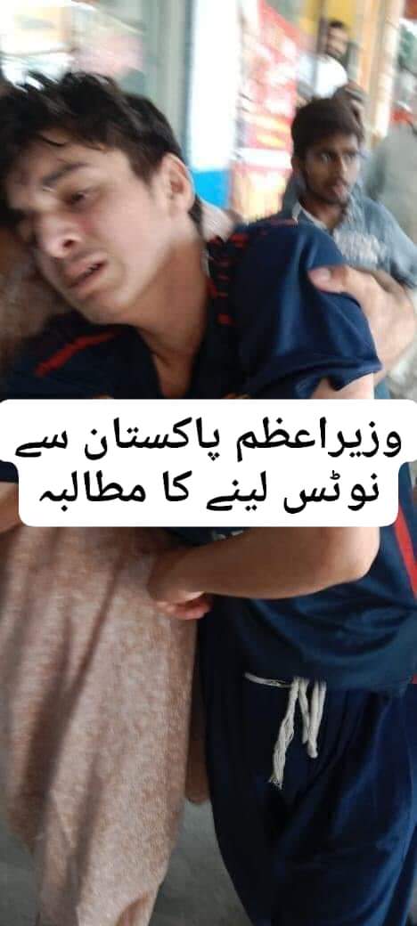 MSamiUllah_786's tweet image. افسوسناک خبر۔  
اطلاعات کے مطابق لاہور کے علاقے فردوس مارکیٹ  کوئٹہ کیفے میں پولیس نے ایک غریب ہوٹل والے پشتون نوجوان کا بازو صرف اسلیے توڑ دیا کیونکہ ان سے کھانہ پہنچانے میں دیر ہوگئی تھی ۔ہوٹل کے مالک کے بقول پولیس والے ان سے فری میں کھانے کھاتے ہے اور جب انکو انکار کیا جاتا ہے…
