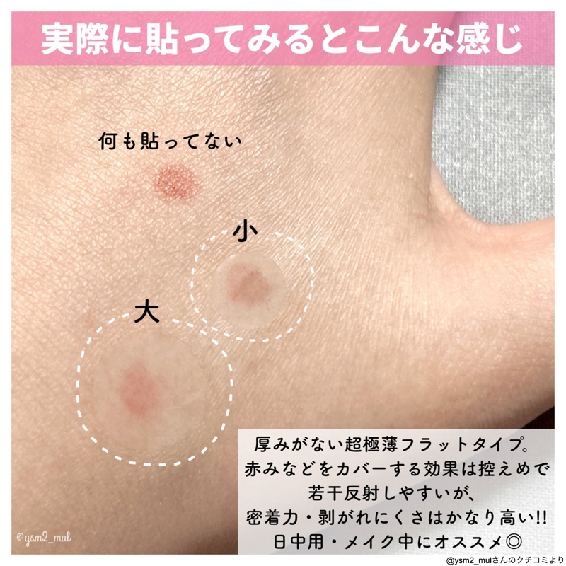 バズりシリーズからニキビパッチ出たよ🥰/ 可愛すぎるイラスト バズりシリーズからニキビパッチ出たよ🥰/ 可愛すぎるイラスト