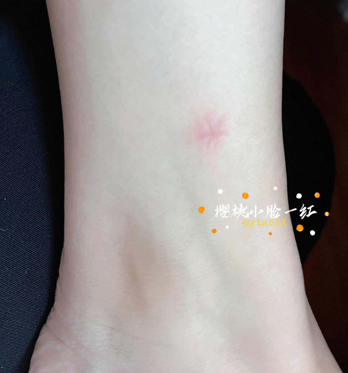 ytaoXX's tweet photo. 来着月经还给你们拍好看的照
结果被蚊子咬了😭
再不点个关注  我要闹了😭

🖤@jiaoshiwb
🖤@yohuo001

#不一样的又或
#不一样的又I或

我已入驻又或，超专业的小众平台 https://t.co/LcTtGb6BrD
🌹闲置，认准又或就对啦！
邀请码：n8KexX https://t.co/IVJyCSxYbb