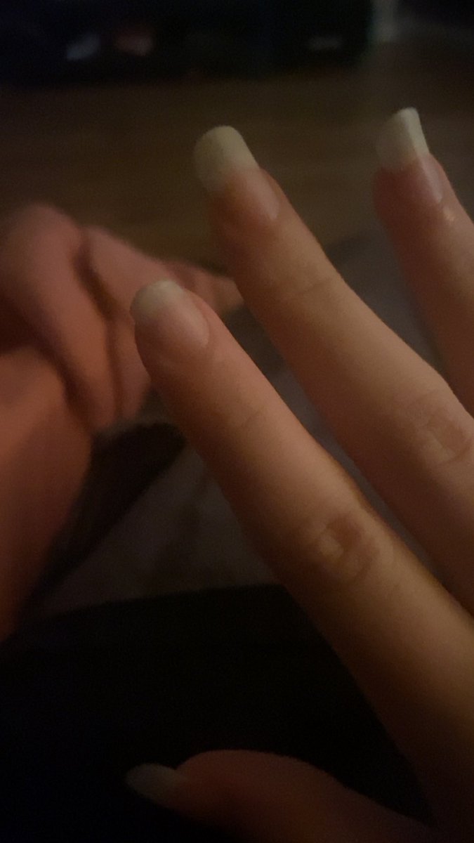 H0LLOWED0UT's tweet photo. MY NAIL BROKE AND NOW MY HAND LOOKS SO WEIRD im gonna trim them today https://t.co/z7FpHlW8lf