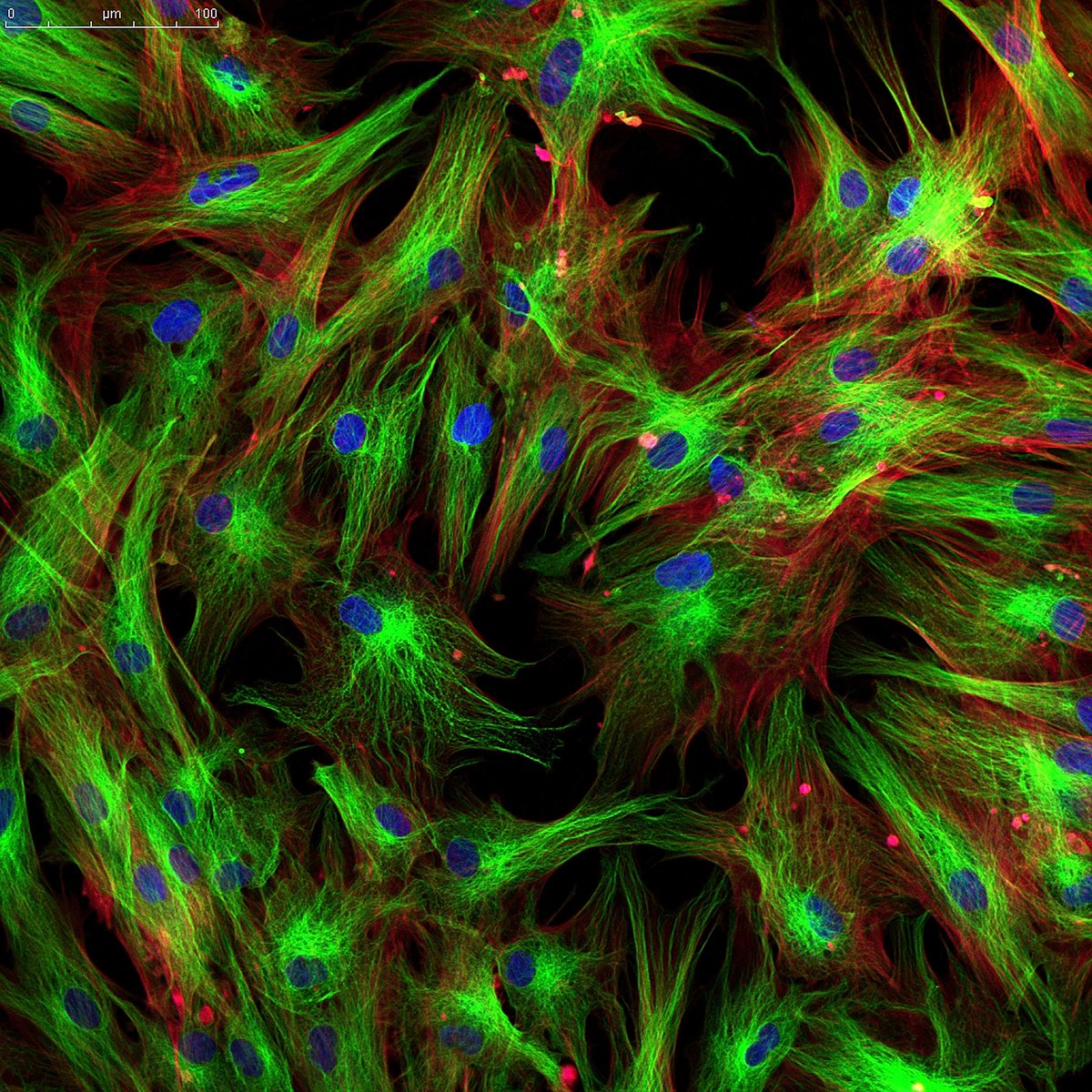 AmalusTx's tweet photo. What we do (2/2)? Our technology modulates disease-associated fibroblasts with unprecedented selectivity, resulting in precise tissue remodeling and normalization. This generates multiple therapeutic benefits, ultimately improving patient survival and quality of life. https://t.co/RXqJw4kfWz