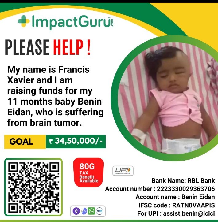 saju_sharan's tweet photo. Help is needed 🙏🥲
@CMOTamilnadu @Udhaystalin @gvprakash @Kavin_m_0431 @Dir_Lokesh @Nelsondilpkumar @arivalayam @immancomposer
@KanimozhiDMK @iamvijayvasanth
#dmk #ADMK #askcm #CMMKSTALIN #savechild https://t.co/3P5Yv57vfb
