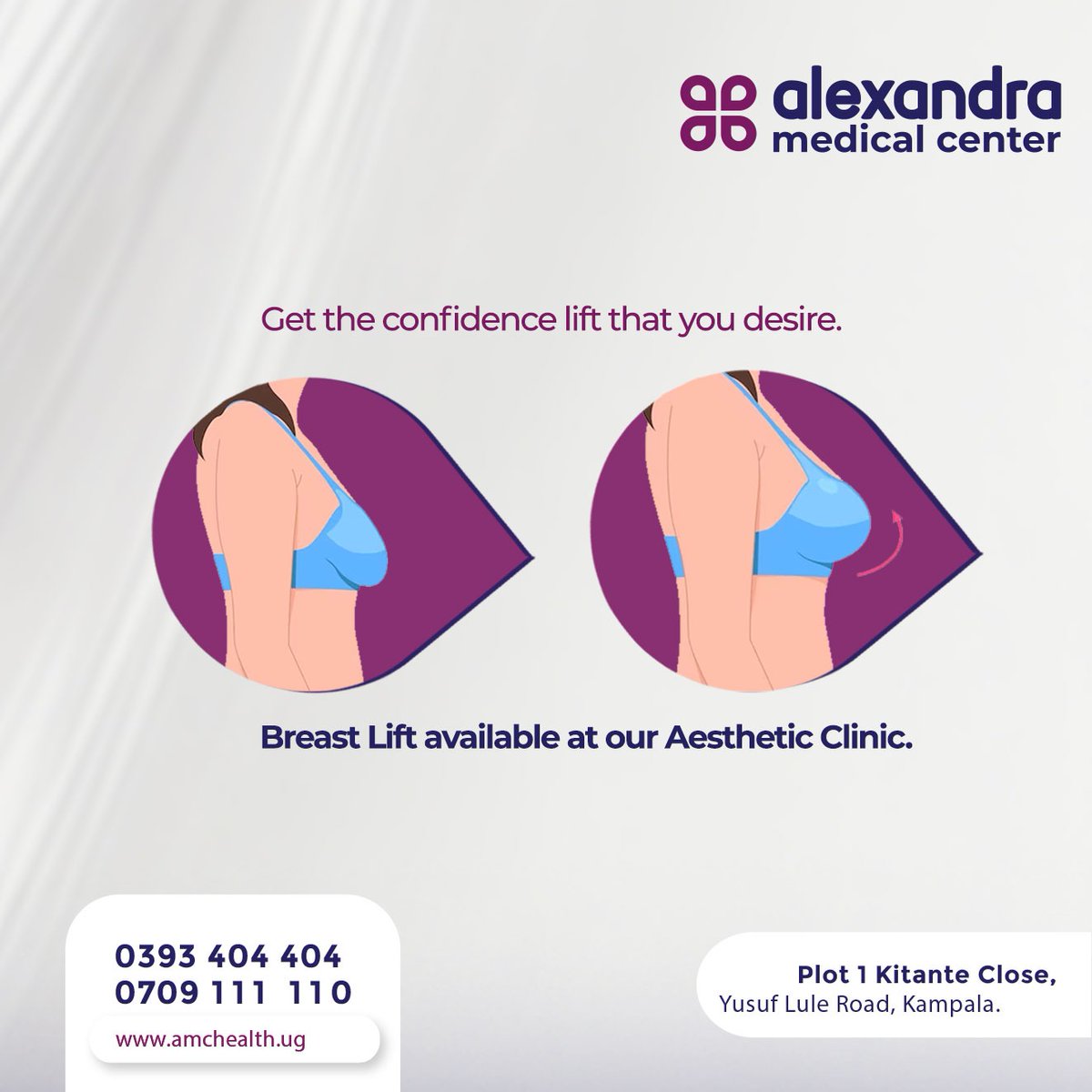 Your desirable look is now achievable!

Check in for Breast Lifting to prevent sagging breasts and achieve your desired breast shape at our Aesthetic Clinic.

#AlexandraMedicalCenter #BreastLift #Confidence