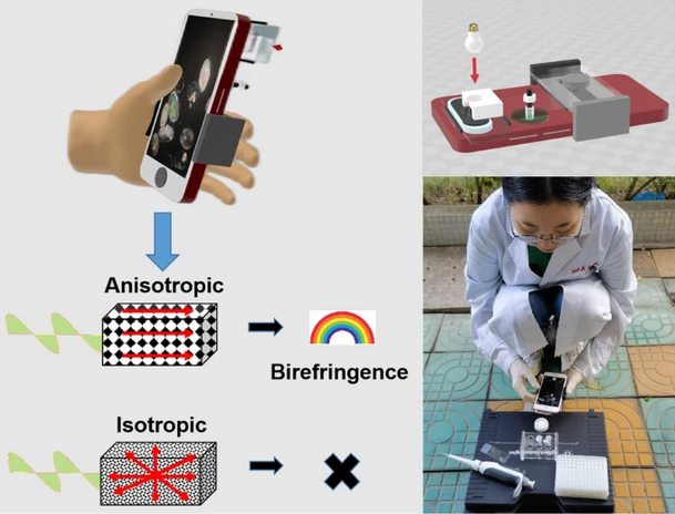 AnalBioanalChem's tweet photo. Smartphone-based hand-held polarized light
#microscope for on-site pharmaceutical #crystallinity characterization
by Kaisong Yuan et al @ShantouUniv @yuan_ks #testing #smartphone #API #YoungInvestigators #Analytical #Chemistry
https://t.co/WpXehu2aIL https://t.co/8FMICGJb6l