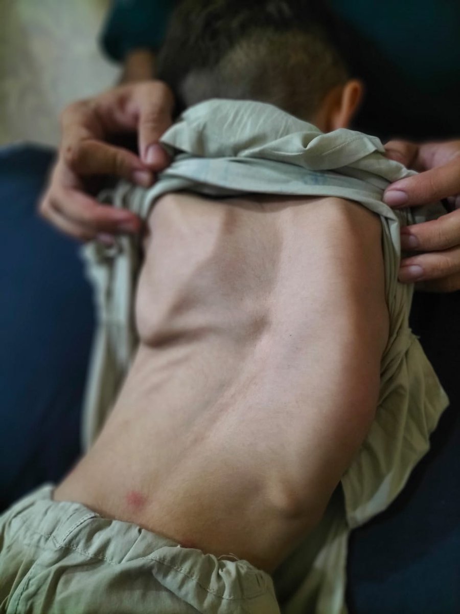 HHCSARPD's tweet photo. Daily Activity
Rehabilitation (Physiotherapy)
Association for the Rehabilitation of the Physically Disabled
#arpd #physioterapy #peshawar #rcpd #helpingothers #helpinghearts #rehabilitation #skillsdevelopment #SkillsForLife #skills https://t.co/yJF2DoC58h