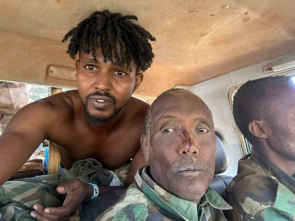 GaraadMukhtaar's tweet photo. This is the way we (the SSC-Khatumo, both the leadership and people) treat prisoners of war (PoW), unlike the Somaliland regime. We are not like them and will never be like them. The way our leaders, our troops, our police, and our society act is shown by how they treat others, prisoners or wounded or deceased. We will hold them with the highest dignity and rights they deserve. 
Gobanimo is our statute. 

@SSCKhaatumo @IsimadaSsc @UnitedSomalis @UNSomalia @US2SOMALIA @US2SOMALIA
