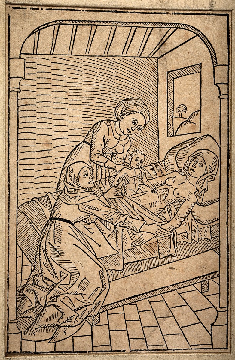 1483 illustration of a C-section on a dying woman performed by midwives.  Courtesy of Wellcome Images.