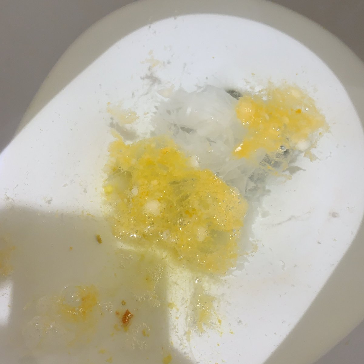 ofujoshi4's tweet photo. 気持ち悪い
胃が痛くてやばいやばいって慌てて病院行こうとしたら電車の中で限界感じて人駅で降りて今ゲロったとこ

うぅぅ胃が痛いし気持ち悪いし最近早上がりしてばっかだしもうやだー https://t.co/SdneQwK48j