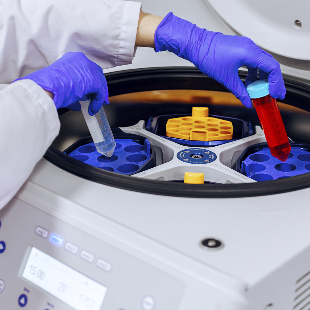 La recomendación de la Comisión de Hematología de The Lancet es clara: las naciones en desarrollo, tienen a muchos pacientes afectados por la Anemia de Células Falciformes, deben expandir sus capacidades para llevar a cabo #trasplantes de #célulasmadre.

acortar.link/saTyK4