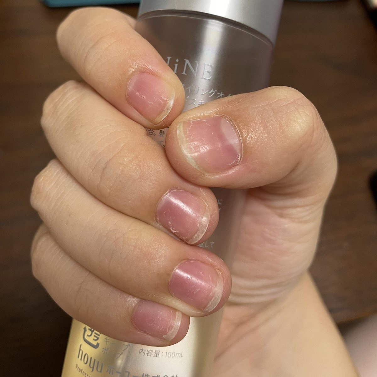 do_without24's tweet photo. ストレス溜まるとネイル剥がしてしまう～！この癖治るまでジェルネイルは辞めよう… https://t.co/co1FKkgMqX