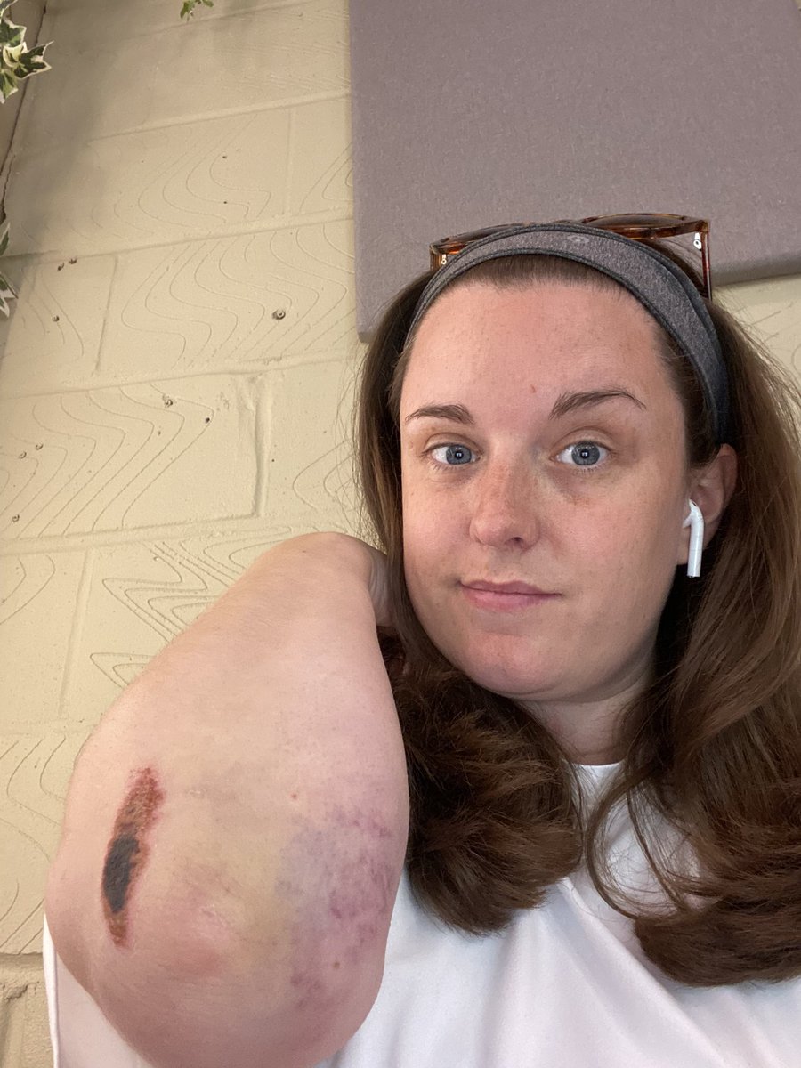 Emily Glenister tweet media