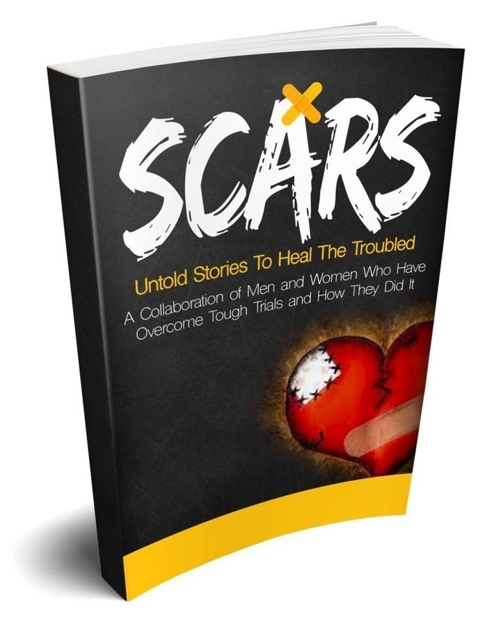 'SCARS' is a collaboration of incredible people who have gone through several challenges but have figured a way to overcome these challenges. Order today angelwritellc.com/scars/
.
.
. 
#AngelWriteLLC #Author #Authors #Book #Memoir #Coach #Coaching #FemaleAuthor #Reading #Read ...