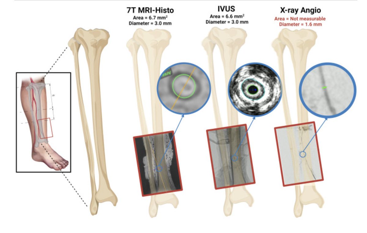 Trisha L. Roy MD PhD FACS tweet media