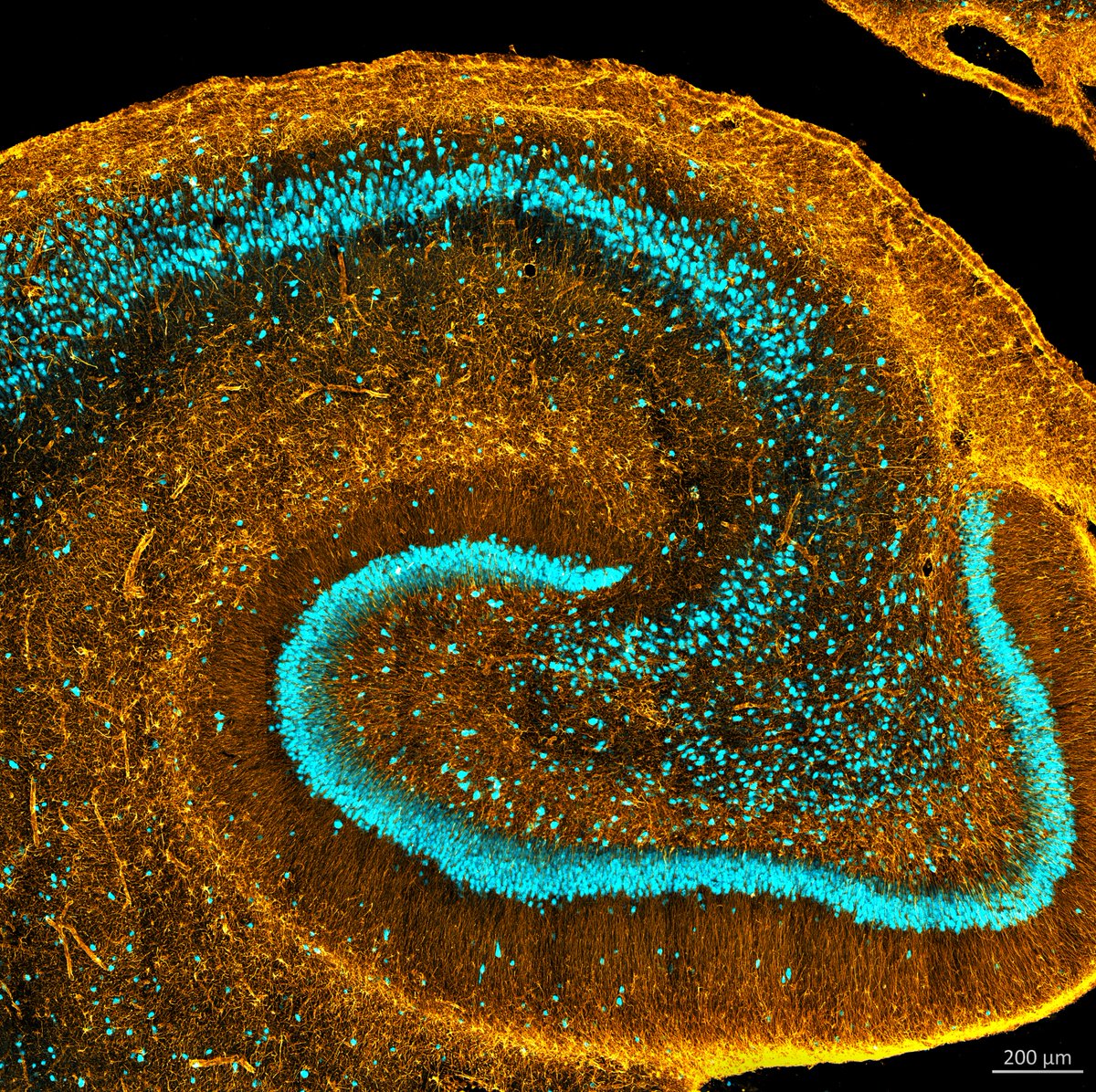 Danielle Beckman (@danibeckman) on Twitter photo #FluorescenceFriday with the majesty, a neonatal hippocampus!🐒 🧠 The lack of complex myelinization at a young age helps a lot with antibody penetration 😁! Markers: 🔵NeuN, 🍊Gfap. <a href="/zeiss_micro/">ZEISS Microscopy</a> #FluorescenceFriday with the majesty, a neonatal hippocampus!🐒 🧠 The lack of complex myelinization at a young age helps a lot with antibody penetration 😁! Markers: 🔵NeuN, 🍊Gfap. <a href="/zeiss_micro/">ZEISS Microscopy</a>
