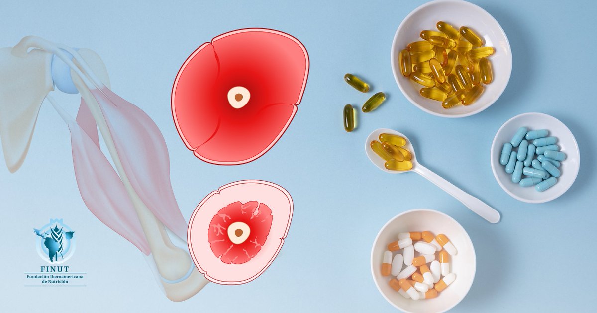 FinutOrg's tweet photo. Avances en la suplementación nutricional para el tratamiento de la sarcopenia, les compartimos resumen sobre una nota publicada recientemente en la revista Frontiers in Nutrition.

#FINUT La nutrición como eje de una sociedad más avanzada
👉 https://t.co/m62nhvCQg9 https://t.co/BtC6j6i0Wq