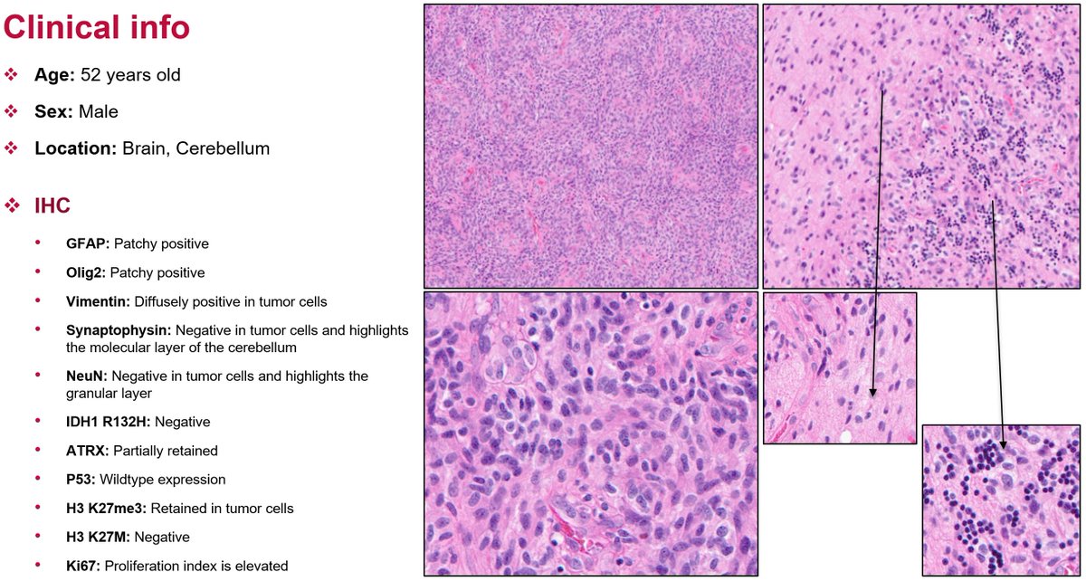 Kenneth Aldape, MD tweet media