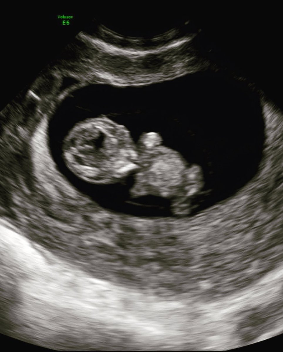 bbbusbee's tweet image. We are excited to announce our little family is growing! Baby BOY Busbee will be joining us next March! We are both feeling very blessed &amp;amp; grateful for this little gift. 💙 We can’t wait to see how much hair he has!! 
#futureBlue