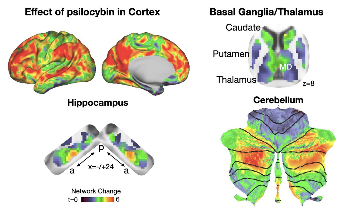realJoshSiegel's tweet photo. The largest change was in the #DefaultNetwork, which creates our sense of self.
But it wasn’t only in cortex! DMN-connected parts of the thalamus/BG/cerebellum/hippocampus showed changes as well. https://t.co/d4OpCetc1G