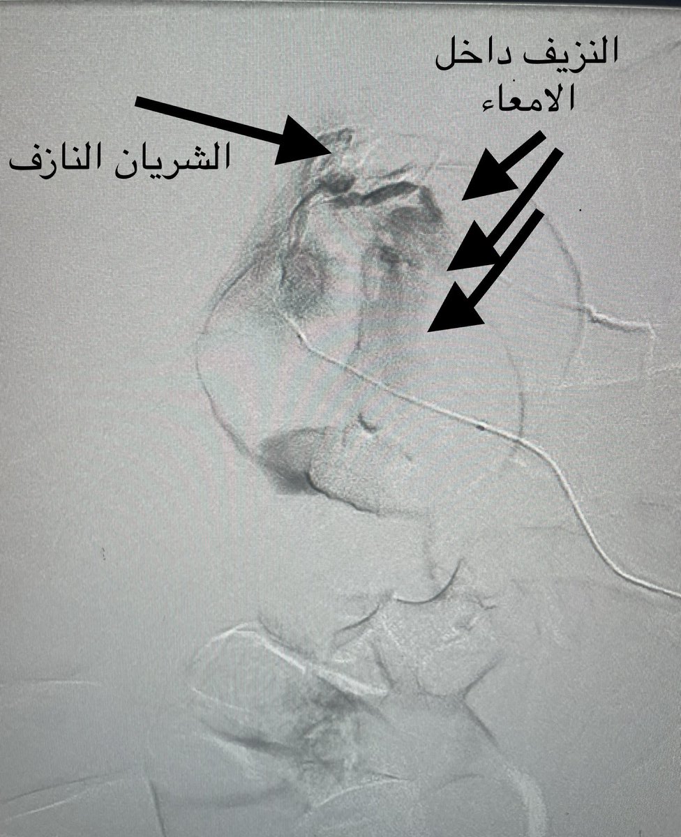 Dr.Bassam Alrehaili, د. بسام الرحيلي tweet media