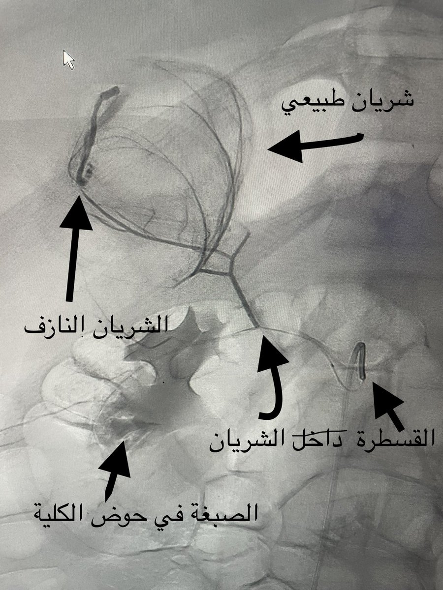 Dr.Bassam Alrehaili, د. بسام الرحيلي tweet media