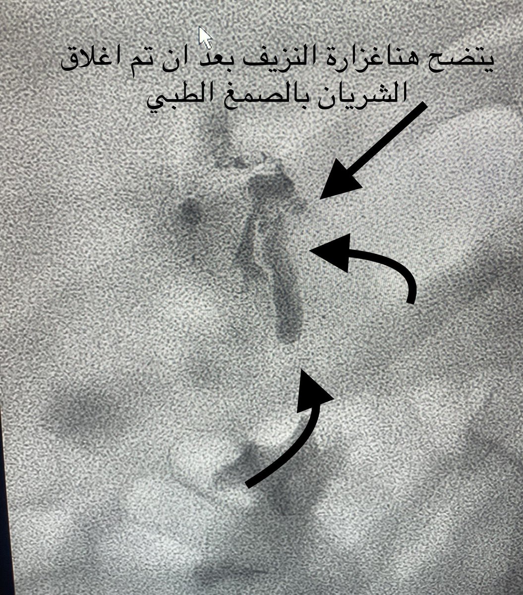 Dr.Bassam Alrehaili, د. بسام الرحيلي tweet media