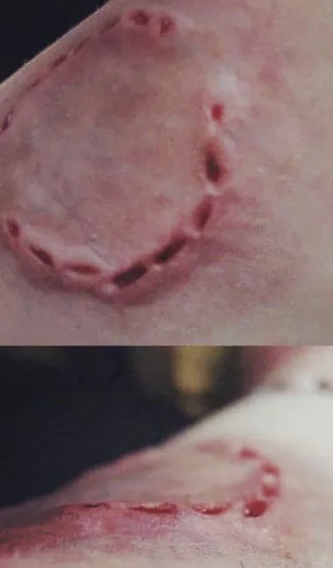 What animal did this? How do you want to manage it?