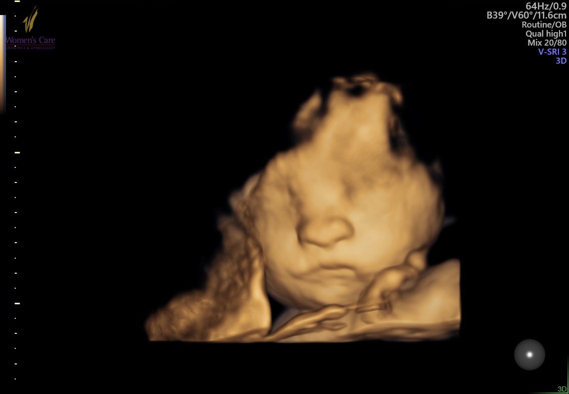 ACJoness_'s tweet photo. Crazy to think in 3.5 hours I’ll be on maternity leave. 😳💙😅 just waiting on little man to make his arrival 🥹 #boymom #keepingupwiththejoneses https://t.co/iWMt6UVux8