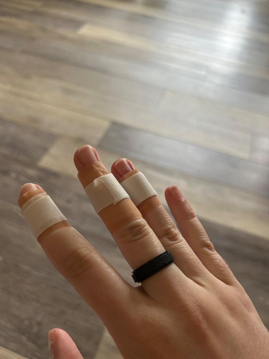 stromfyr's tweet photo. tw// slight blood 
found out why they're known for that today! holding him was worth it tho! fun fact- tokay gecko spit is an anticoagulant (blood thinner) so bites look worse than they are. https://t.co/axy0bAMIe0