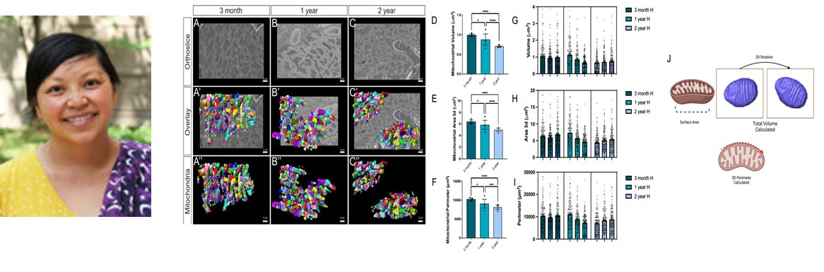 Our paper Three-Dimensional Mitochondria Reconstructions of Murine Cardiac Muscle Changes in Size Across Aging is out in @ajpheartcirc & is on @PubTrend: doi.org/10.1152/ajphea… Congrats to my postdoc @ZerVue on your 1st of 5, 1st author manuscripts. @merrylindseyphd EIC is a🌟