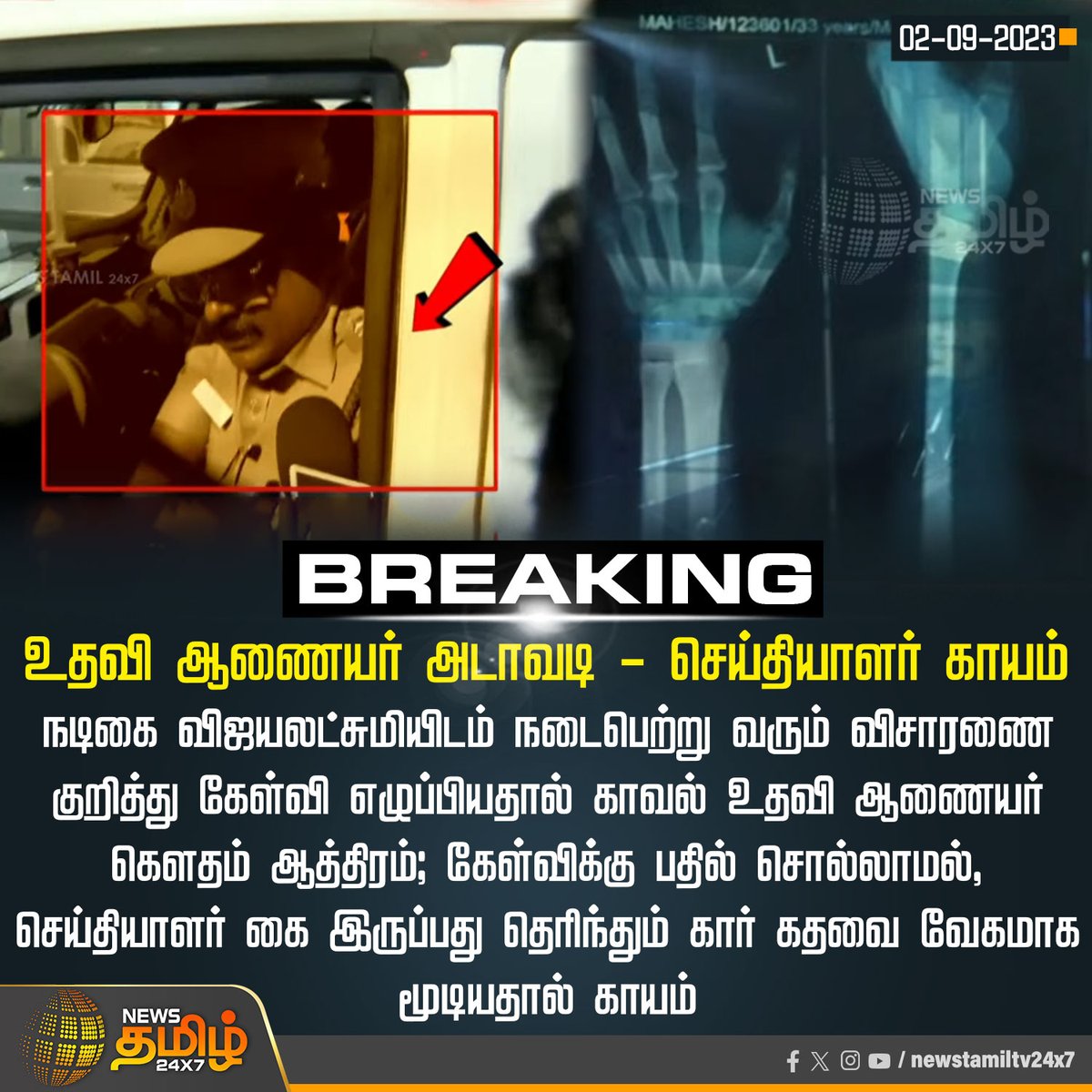 NewsTamilTV24x7's tweet photo. #BREAKING | உதவி ஆணையர் அடாவடி - செய்தியாளர் காயம்
#NewsTamil24x7 | #SeemanVijayalakshmiCase | #AssistantCommisioner | #ReporterAttack https://t.co/JgOFiU5Bb3