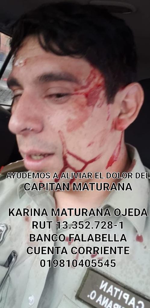 URGENTE !!!
ATENCION !!
CAMPAÑA DE AYUDA AL CAPITAN PATRICIO MATURANA Y SU FAMILIA !
REMATARAN LA CASA DE SUS PADRES Y HERMANA.
QUE CORRA !!
TODO APORTE ES BIENVENIDO !!
#ResisteMaturana
ABAJO LOS DATOS !
SUMATE !!