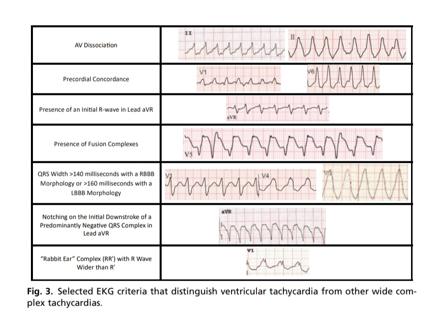 SOMELaguna's tweet photo. Manejo de las Arritmias en la Unidad de Cuidados Intensivos Cardiovasculares 🫀🏥

📚Crit Care Clin 2023

https://t.co/YDbFTK7asc

Enlace a Articulo completo ✅ 👇🏼🆓️
https://t.co/RI53cNd6PS https://t.co/wR5oGkL4f2
