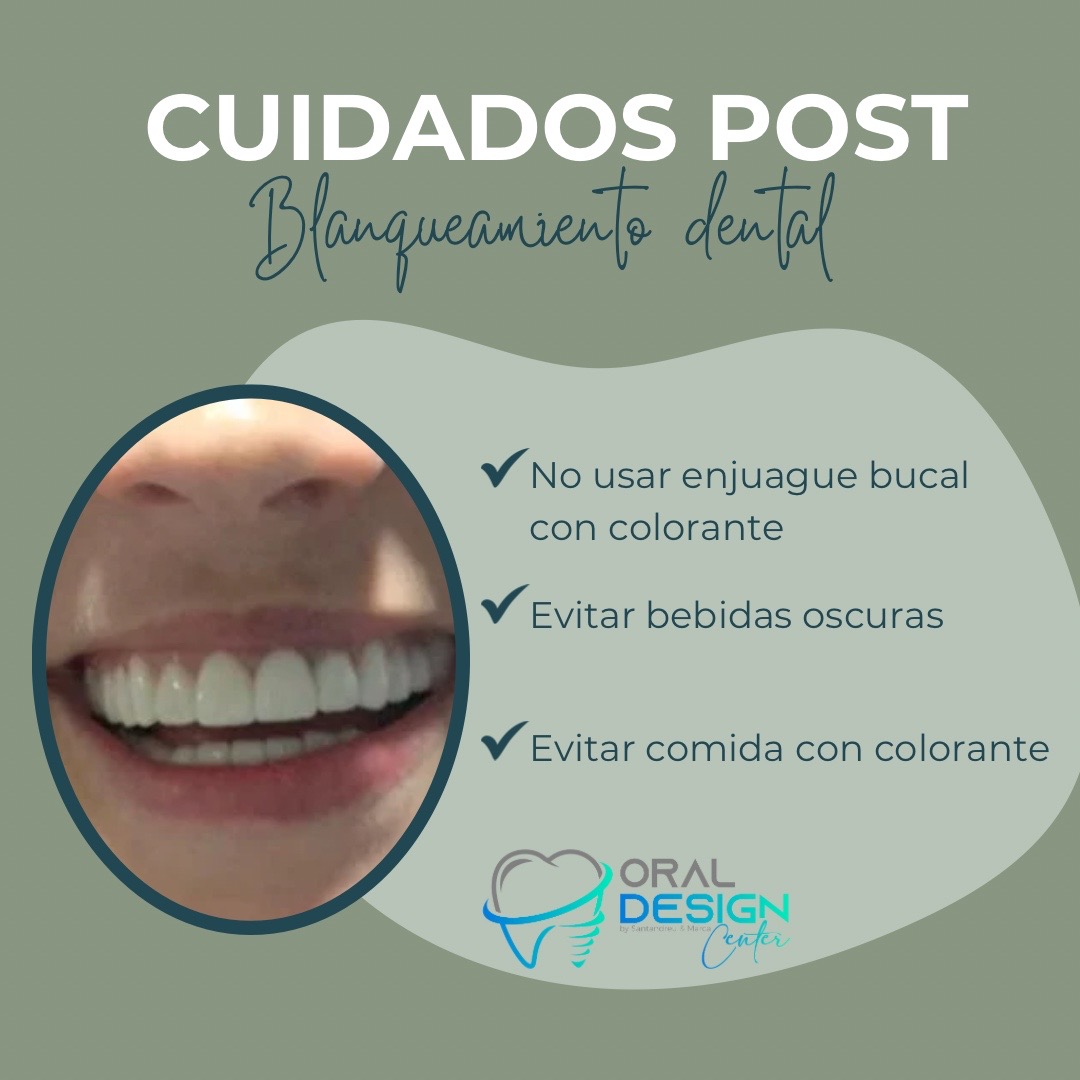 oraldesignpco's tweet photo. Cuidados post blanqueamiento 🤗

3 cuidados que no debes saltar luego de hacerte un blanqueamiento dental ⬇️

#blanqueamientos #cuidados #dentales #consulta https://t.co/PsIu9hXWTm