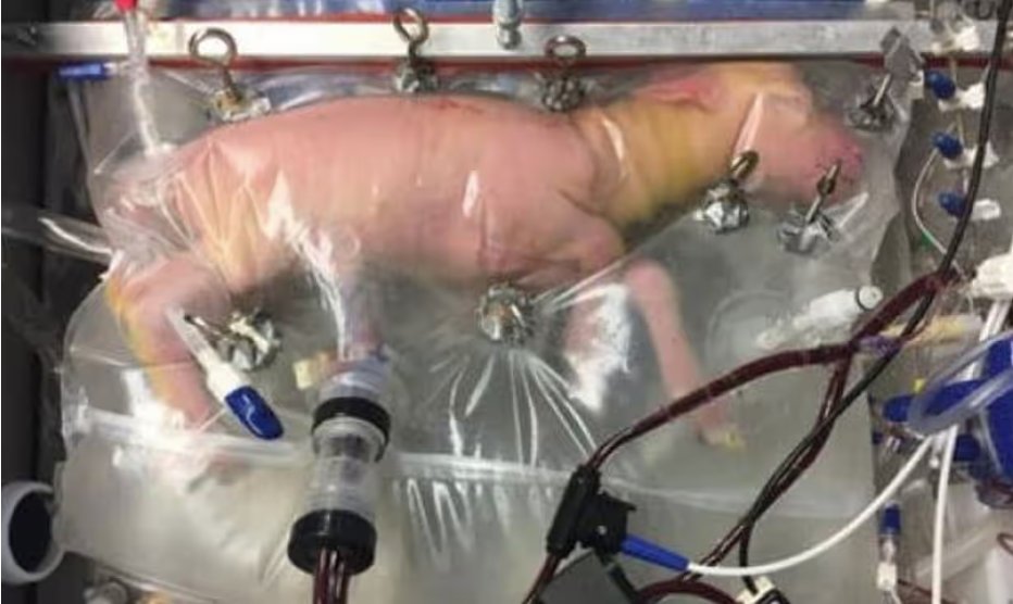 Artificial wombs are a fast-approaching technology. In 2017, researchers at the Children’s Hospital of Philadelphia developed a Biobag that successfully gestated lamb fetuses to term They hope to test this technology on human babies within the next few years. [Thread]